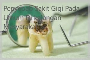 Penyebab Sakit Gigi Pada Umum Di kalangan Masyarakat